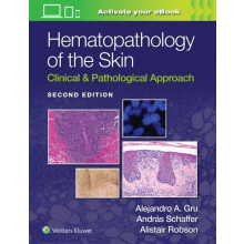 Hematopathology of the Skin by ALISTAIT ROBSON Hardcover Book