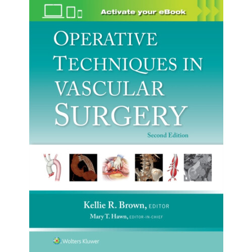 Operative Techniques in Vascular Surgery Print book with Multimedia Ha