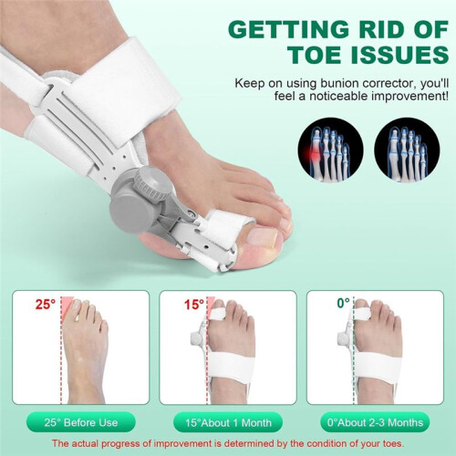 Bunion Corrector for Women  Toe, 1PCS Bunion Corrector, Adjustable with Non-Slip  Toe Separator Left Foot 2