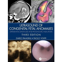 Ultrasound of Congenital Fetal Anomalies by Paolo Volpe Hardcover Book
