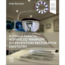 A Clinical Guide to Advanced Minimum Intervention Restorative Dentistr