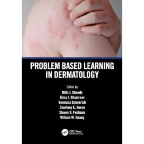 Problem Based Learning in Dermatology Paperback Book
