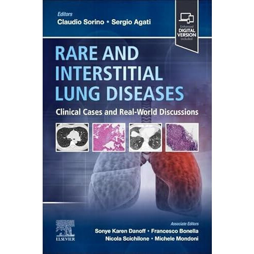 Rare and Interstitial Lung Diseases Paperback Book
