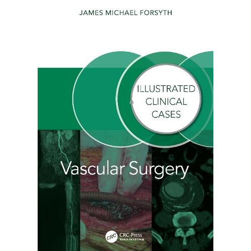 Vascular Surgery by James Forsyth Paperback Book