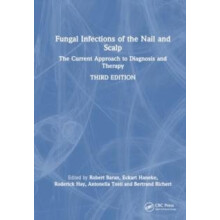 Fungal Infections of the Nail and Scalp Paperback Book