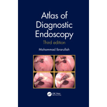 Atlas of Diagnostic Endoscopy 3E by Mohammad Ibrarullah Paperback Book