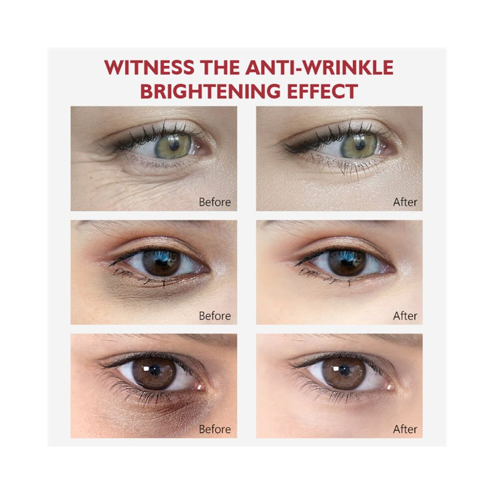 Spactz Veze Nicotinamide Eyes Cream Dark Circles Remove Eye Bags Under Eye Acid Moisturizing Serum Against Puffiness Eye Care Gel