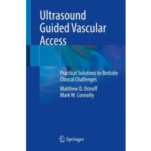 Ultrasound Guided Vascular Access by Mark W. Connolly Paperback Book