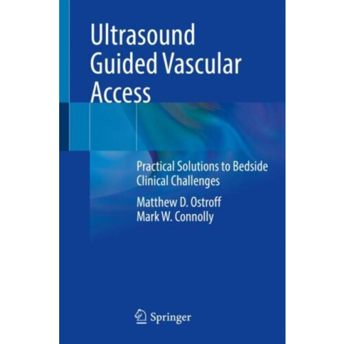 Ultrasound Guided Vascular Access by Mark W. Connolly Paperback Book