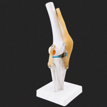 Anatomical Medical Knee Joint with Ligaments Model,Life Size,Orthopedic Teaching Demonstration