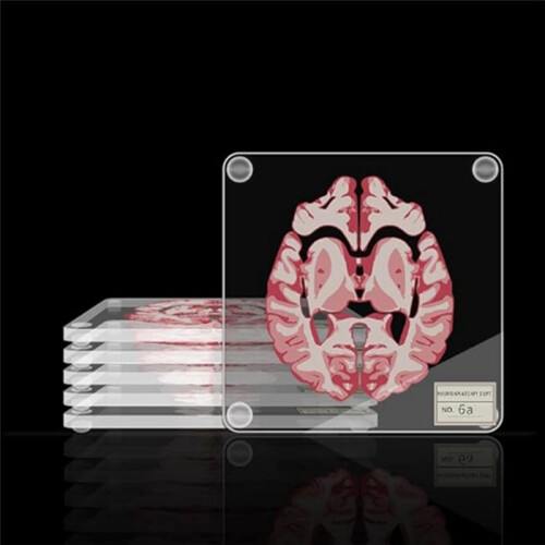 Brain Specimen Coasters Set 3D Organ Brain Artwork Brain Slices Square Acrylic Drinks Table Coaster 2