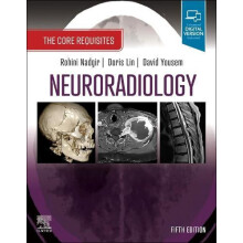 Neuroradiology Paperback Book