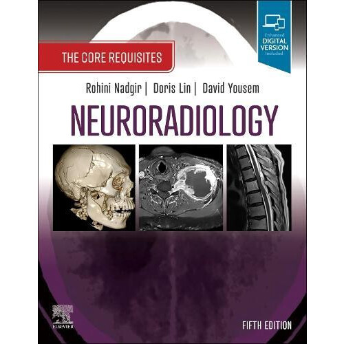 Neuroradiology Paperback Book