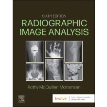 Radiographic Image Analysis by Martensen Kathy McQuillen MA RTR Direct