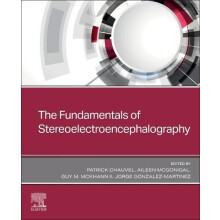 The Fundamentals of Stereoelectroencephalography Paperback Book