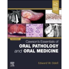 Cawsons Essentials of Oral Pathology and Oral Medicine by Odell Edward