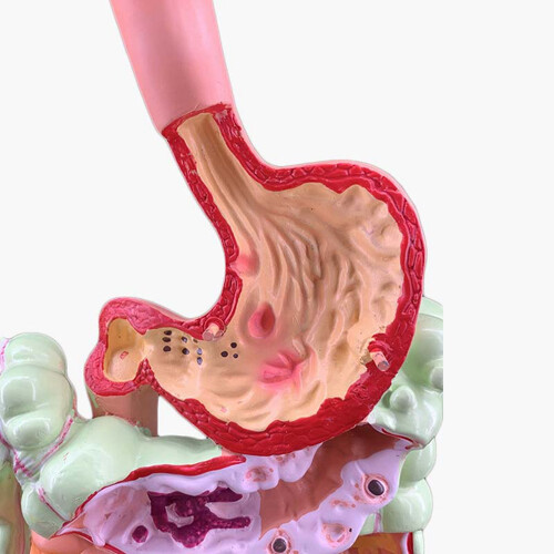 Human Digestive System Model Stomach Anatomy Large Intestine Cecum Rectum Duodenum Human Internal Organs Structure Model 2