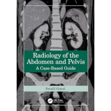 Radiology of the Abdomen and Pelvis by Goyal Swati Gandhi Medical Coll