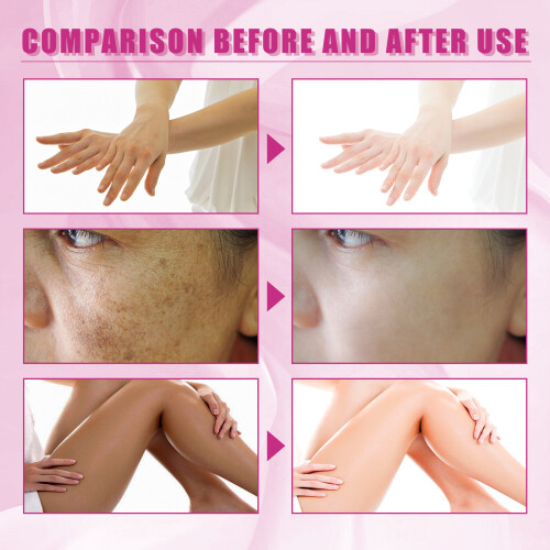 30ml Extra Starkes Peeling-Öl für Hautaufhellung & -regeneration 2