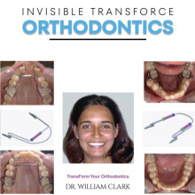 Invisible TransForce Orthodontics by Dr. William Clark Hardcover Book