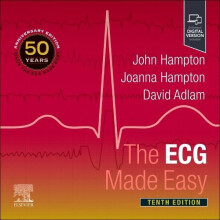 The ECG Made Easy by David Adlam Paperback Book