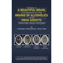 I Have a Beautiful Brain Compared to the Brains of Alcoholics and Drug