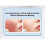 Soothing Stainless Steel Face Massagers 2