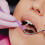 10Pièces Interdentales Violet À Manche Souple Pour Appareils 6