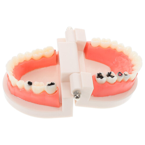 4Pcs Realistic Dentist Typodont Model ABS Multi Teeth for Learning Use 2