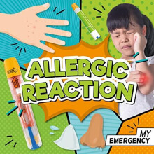Allergic Reaction by Charis Mather Paperback Book