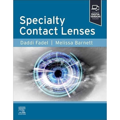 Specialty Contact Lenses Paperback Book