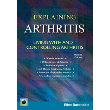 An Emerald Guide to Explaining Arthritis by Ellen Baxendale Paperback