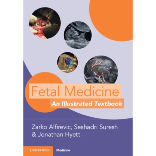 Fetal Medicine Paperback Book