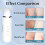 3 Mode Blackhead Remover Tools - Skin Scrubber Face Spatula Blackhead Remover for Deep Cleansing(White) 5