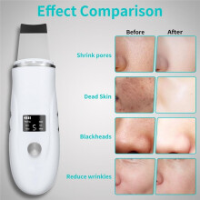 Skin Scrubber Face Spatula - Deep Cleansing Tool for Pore Extraction, Fast Charging Dock Blackhead Remover Face Spatula