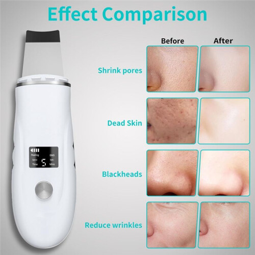 Skin Scrubber Face Spatula - Deep Cleansing Tool for Pore Extraction, Fast Charging Dock Blackhead Remover Face Spatula