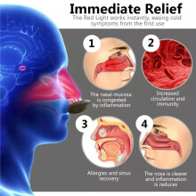 Intelligent Infrared Nose Opening Device Infrared Nose Relief Device Portable Nose Congestion and Nose Relief Device