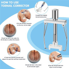 Ingrown Toenail Removal Kit, Professional Ingrown Toenail Treatment Includes Ingrown Toenail Corrector, Tweezer Set