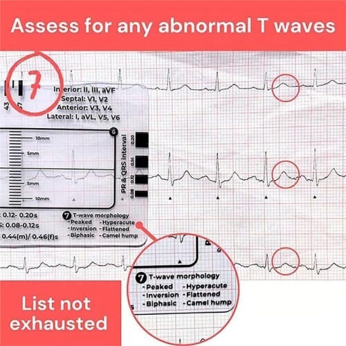 2pcs ECG 7 Step Ruler,ECG 7 Step Ruler for ECG/EKG Interpretation,ECG Reference Guide Ruler,EKG Calipers Measuring Tool 2