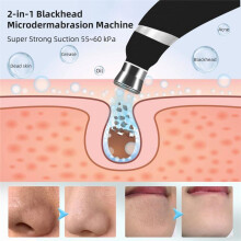 Portable Diamond Peeling Machine Microdermabrasion Facial Cleaning Blackhead Removal Device Handheld Exfoliator Set