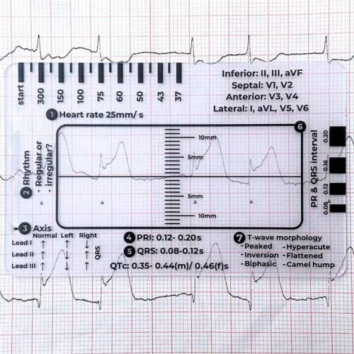 3pc ECG 7 Step Ruler,ECG 7 Step Ruler for ECG/EKG Interpretation, ECG Reference Guide Ruler,EKG Calipers Measuring Tool 2