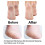 10 pezzi di ricariche rosa per Pedi Micro Abrasive Foot File 5