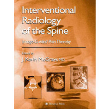 Interventional Radiology of the Spine