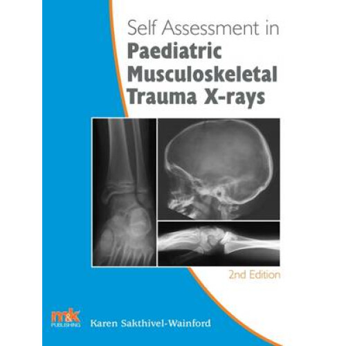 Self-Assessment in Paediatric Musculoskeletal Trauma X-Rays