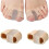 Separatore per alluce valgo – Gel e tessuto, 2 pezzi 1