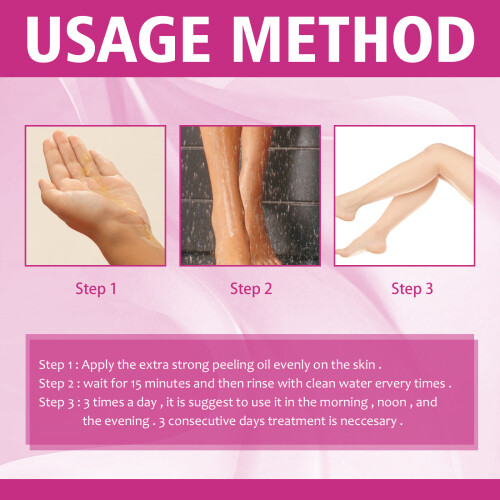 30 ml Extra Starkes Peeling-Öl 2.9x8.7cm Aufhellung 2