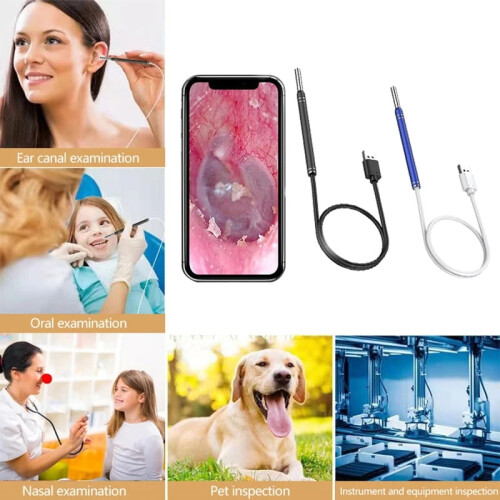 5.5MM HD οπτικό ενδοσκόπιο αυτιού 3 σε 1USB ωτοσκόπιο αυτιού καθαρισμού κεριού 1