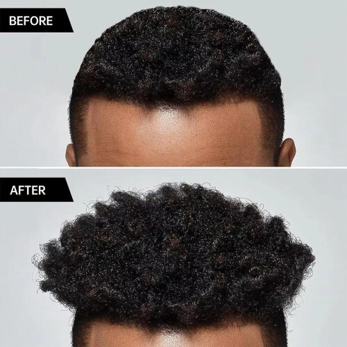 Escova modeladora profissional resistente ao calor – 2 em 1 para cachos e ondas 2