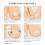 400Pcs Ingrown Toenail Decals Nail Patch Assorted Colors 11