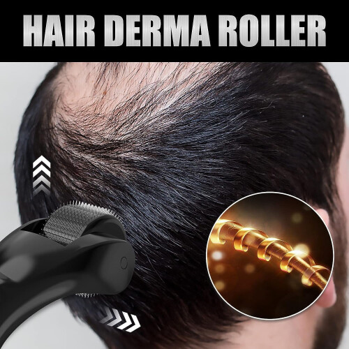 Derma Roller για την ανάπτυξη μαλλιών και γενειάδας - 540Pins Ρολάκι μικροβελόνων τιτανίου 2